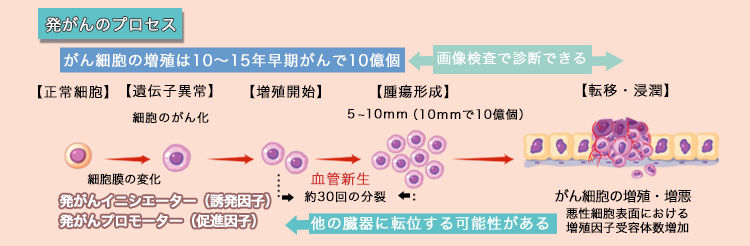 発がんのプロセス　何段階にも遺伝子変異し、増殖すると考えられています。